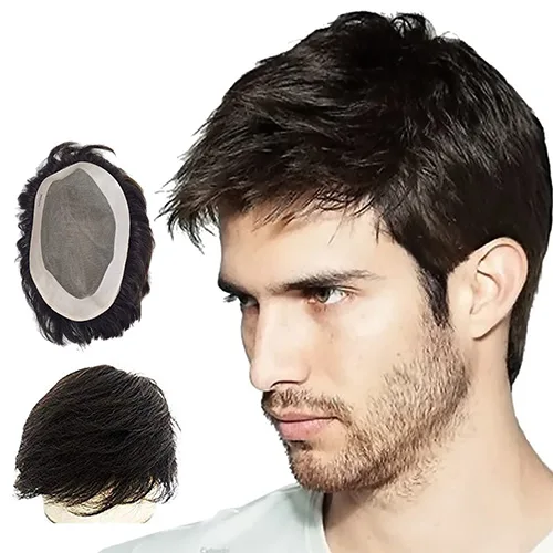 Hair Patch